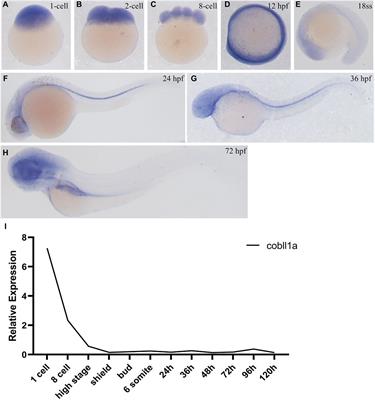 Zebrafish cobll1a regulates lipid homeostasis via the RA signaling pathway